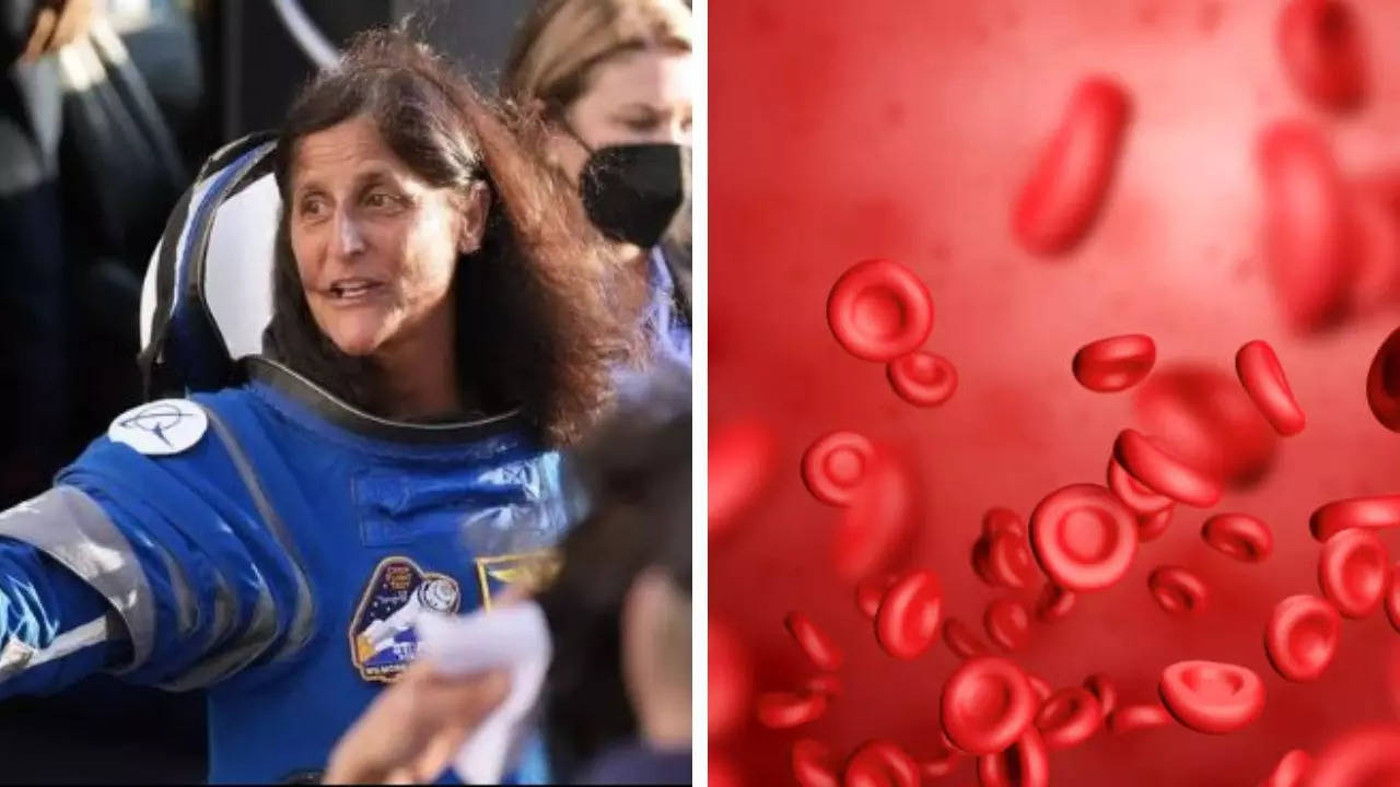 what is space anemia, a condition that could affect astronaut sunita williams?