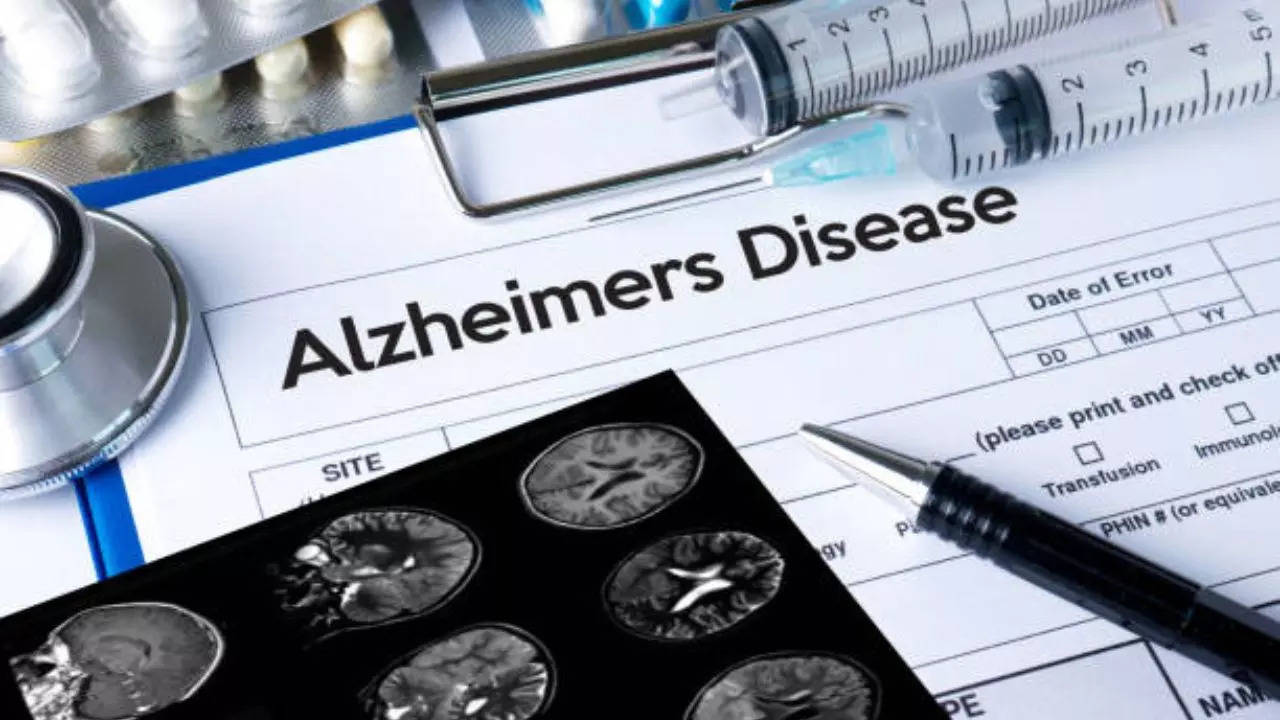 Low Blood Flow To The Brain Causes Alzheimer's Disease; Know Simple Ways to Increase It