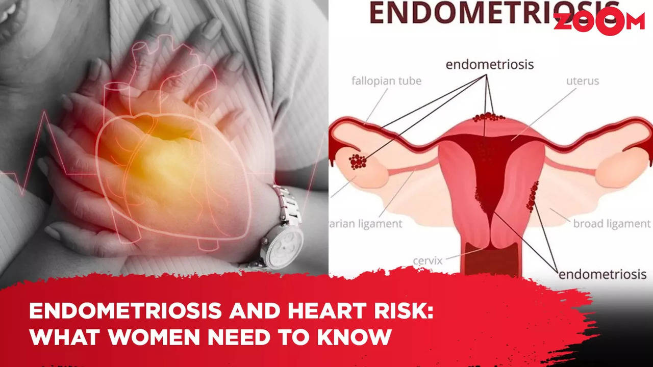 endometriosis and heart risk: what women need to know