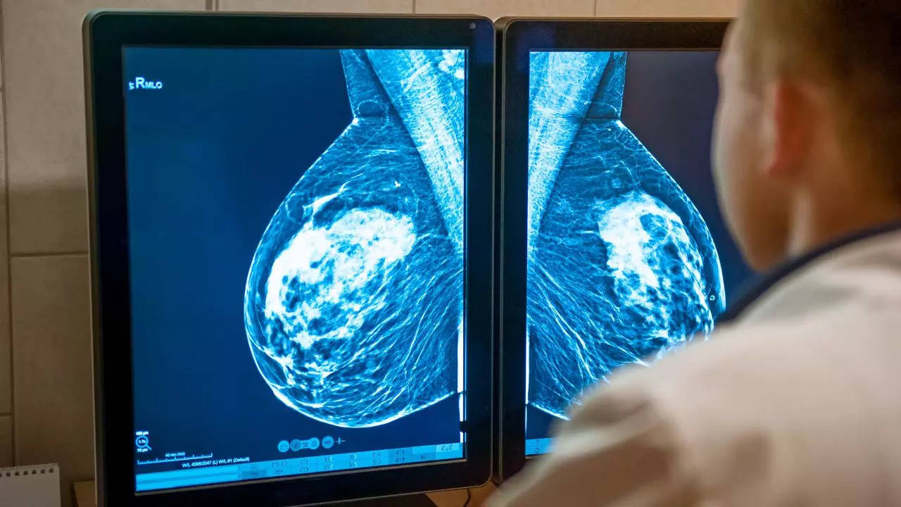 Breast Cancer Awareness Month: THESE Tests Can Help In The Detection Of The Cancer