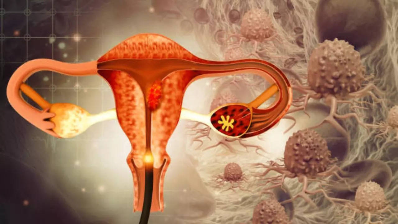 First-ever Ovarian Cancer Vaccine Could Wipe Out The Deadly Disease That Kills Thousands Of Women