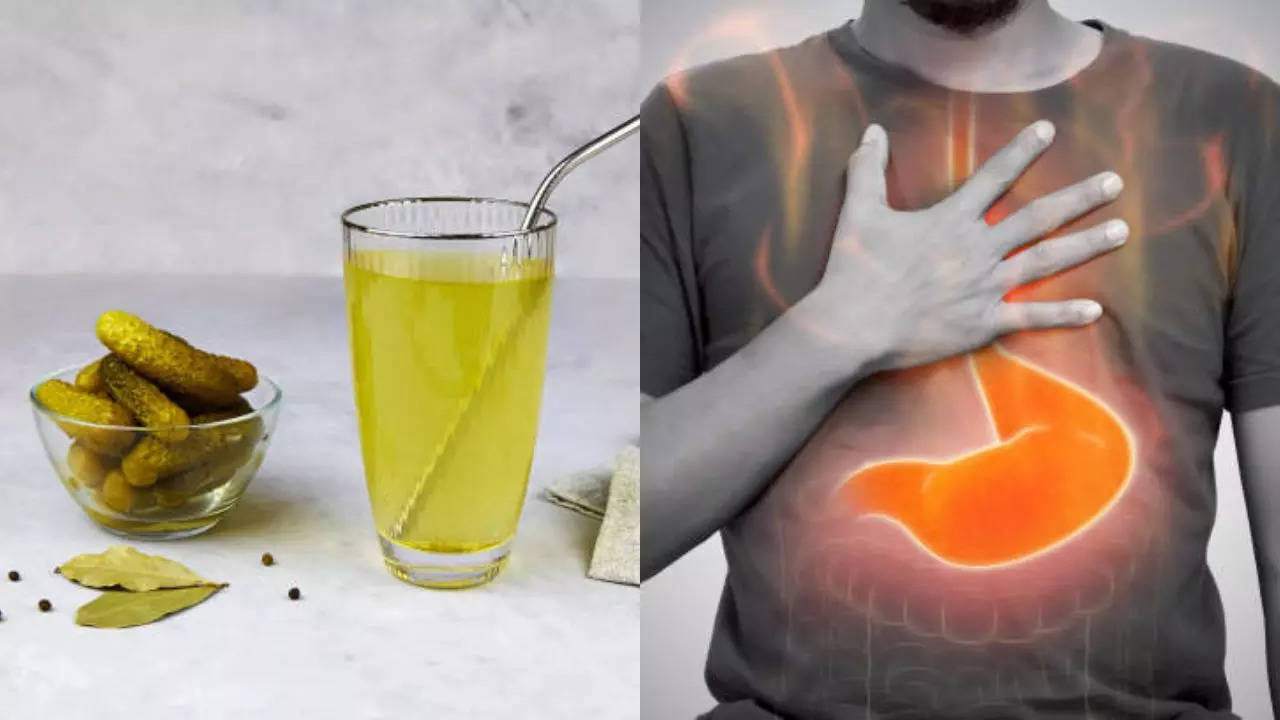 this tangy, delicious drink can help relieve your acid reflux in minutes; know how pickle juice regulates digestion