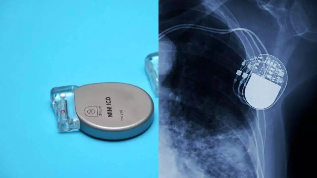 soon you can recycle your old pacemaker to save a life; here's how