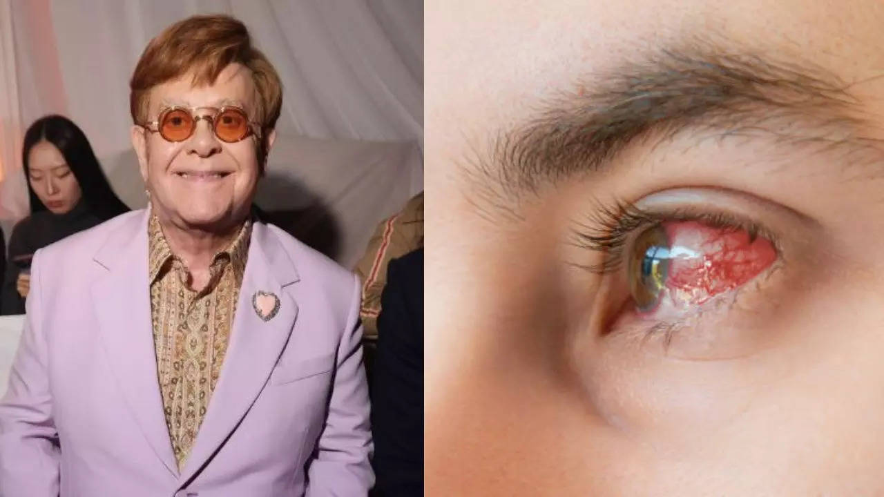 elton john says he is blind in the right eye due to an infection; what is it all about?